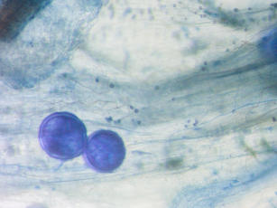 Image of Metodologia para criopreservação de esporos de fungos micorrízicos arbusculares