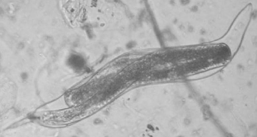 Juvenil de 4º estádio de Meloidogyne spp. (A). 