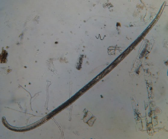 Macho de Meloidogyne spp. formato vermiforme (B).