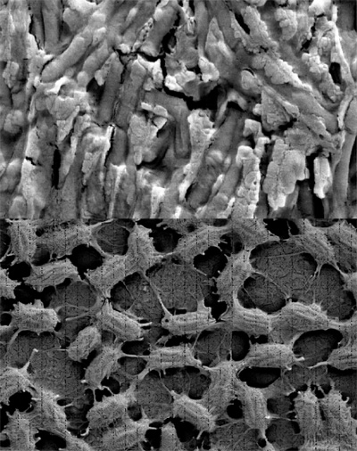 Bacillus subtilis